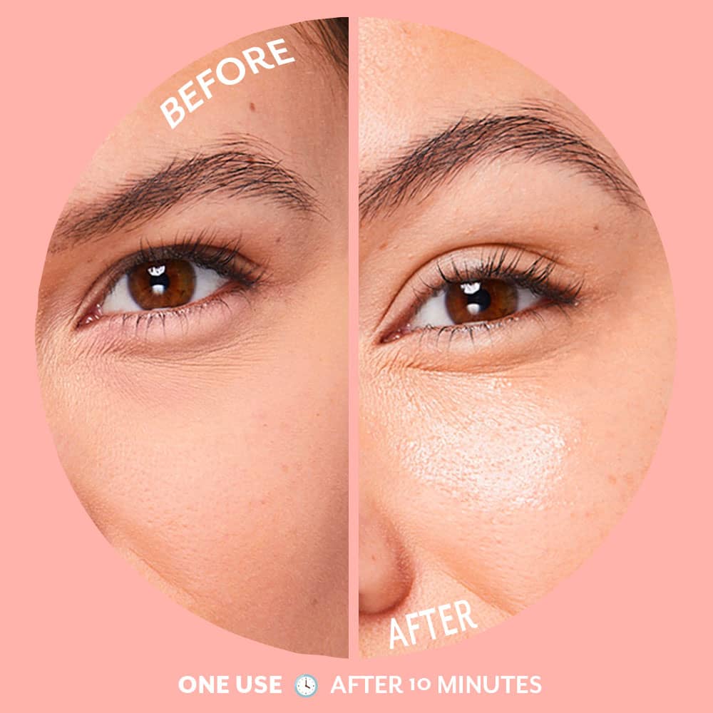 Serve Chilled Bubbly Brightening Eye Gels - 5 Pair